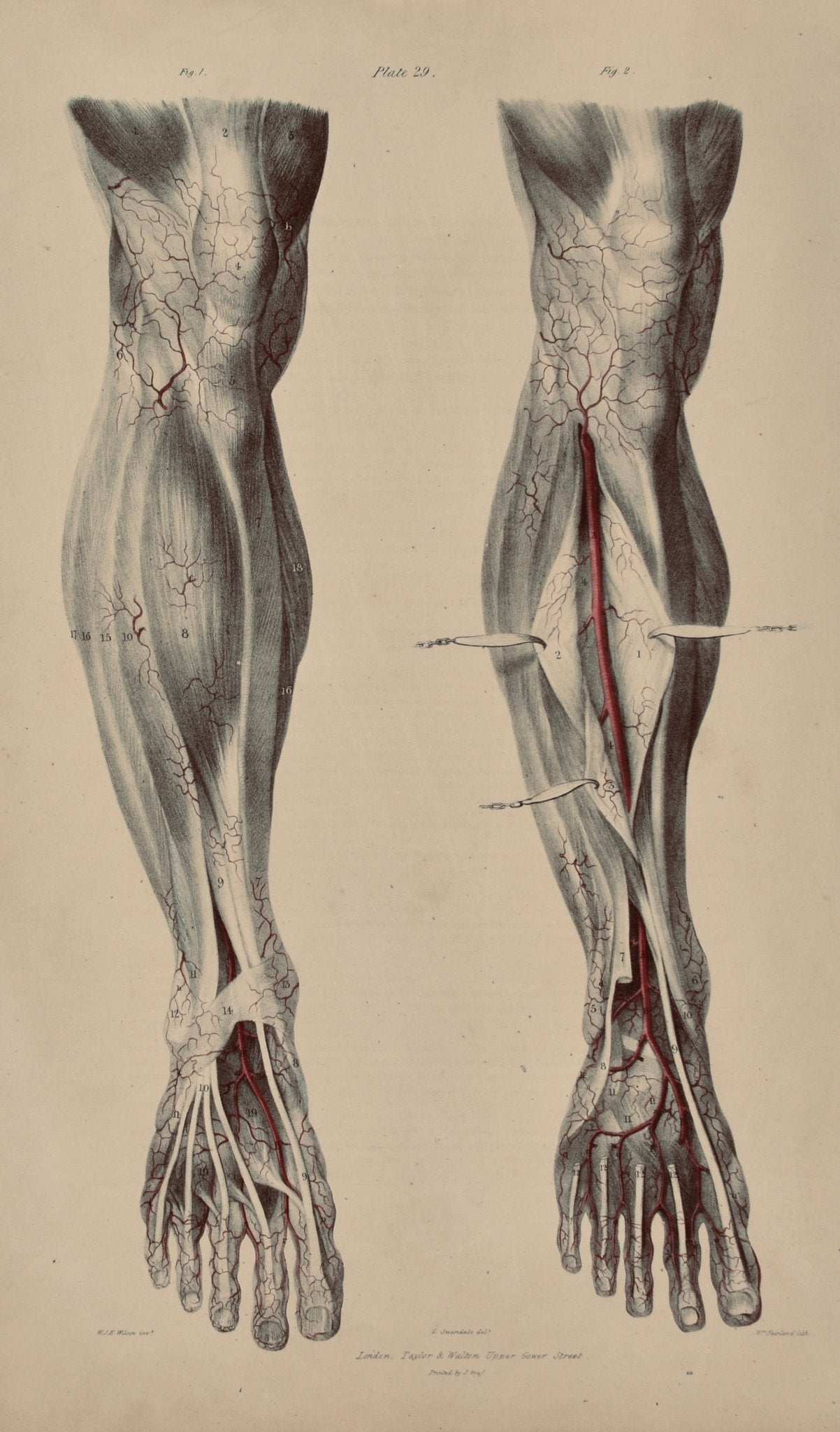 SOLD - Anatomical Original Wall Art - Vascular Leg 29 - Room Four