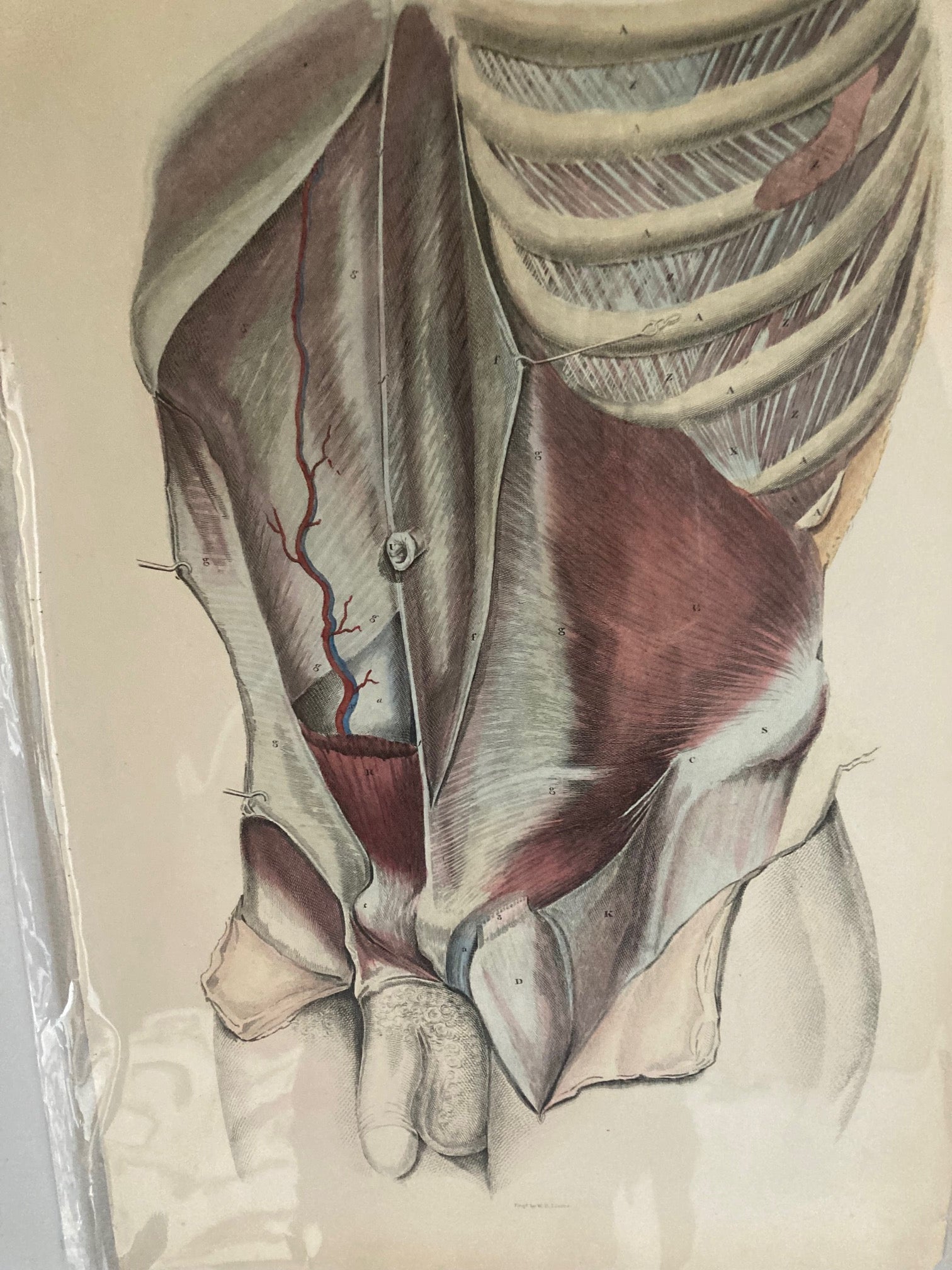 Sold Early Anatomy Coloured Engraving Plate XXX - Room Four