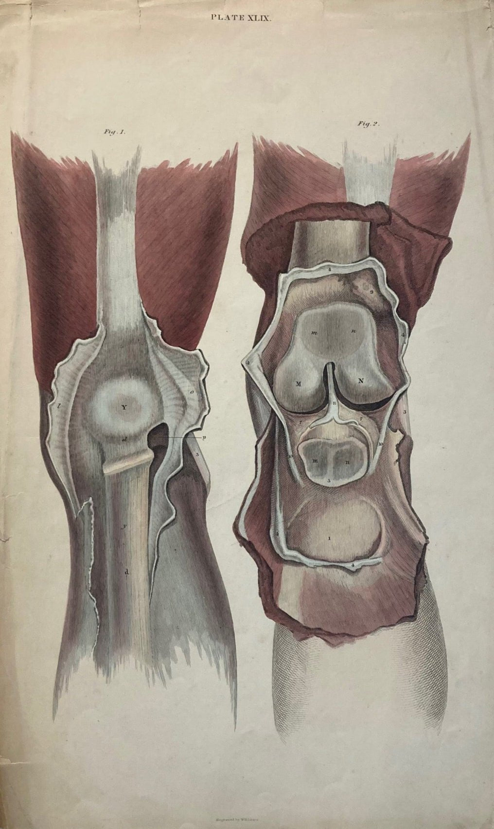 Sold Early Anatomy - Plate XLIX - ORIGINAL - Room Four