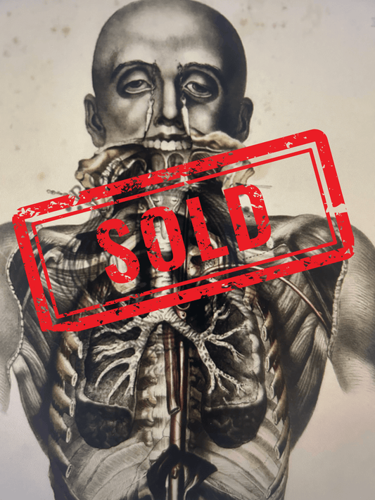 Sold - Human Anatomy Lithographic Print 19th Century - VII - Room Four