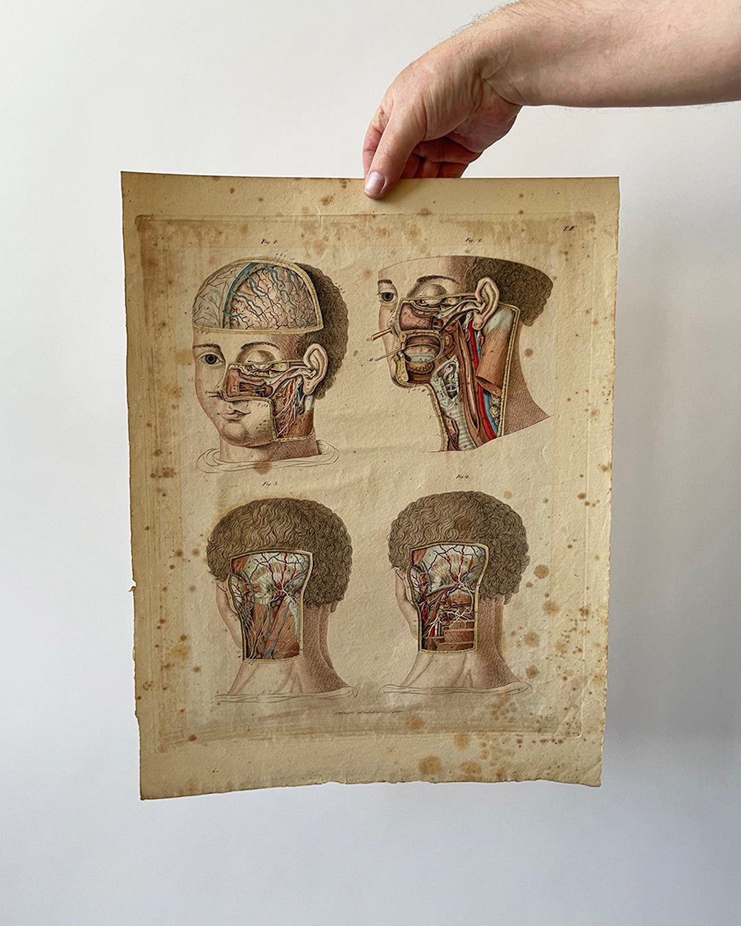 SET Anatomical Engravings - Early 1800's