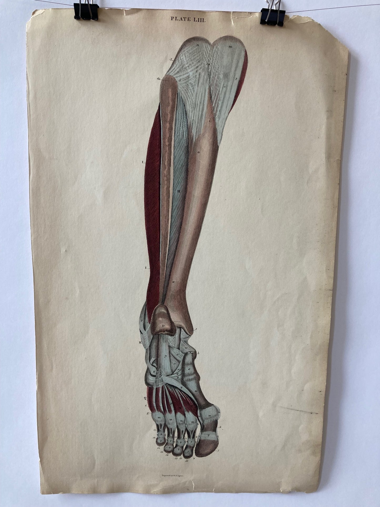 Lizars Anatomical Drawing 19th century original - human anatomy - leg/foot   - plate LIII