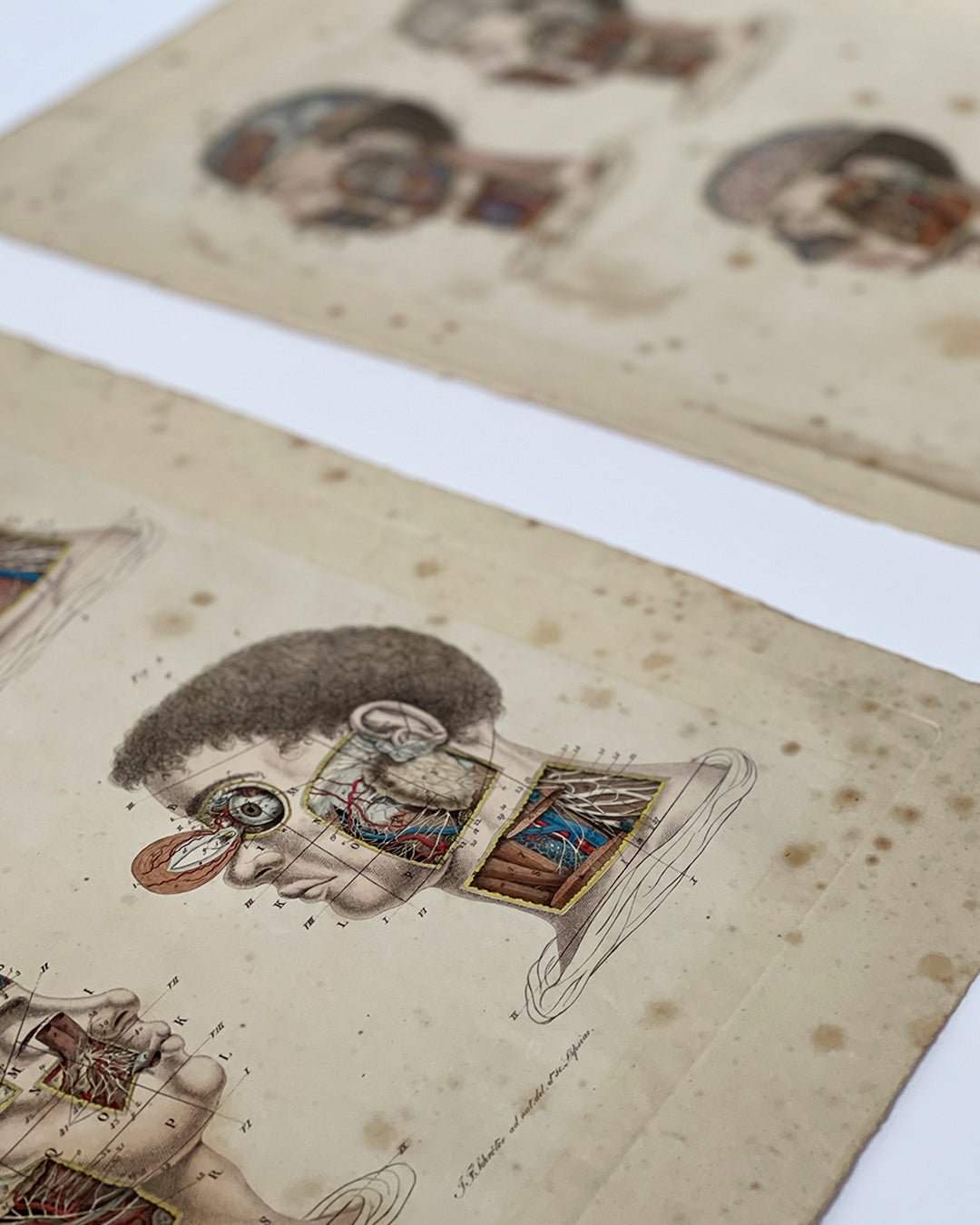 Early Anatomy Coloured Engravings Wall Art Post Mortem - Head - Room Four