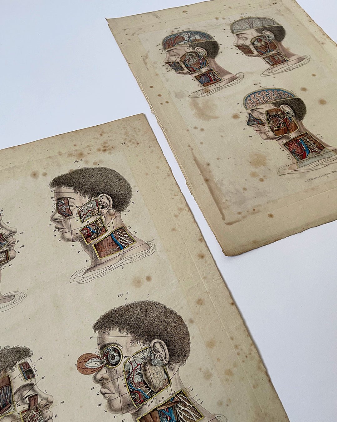 Early Anatomy Coloured Engravings Wall Art Post Mortem - Head - Room Four