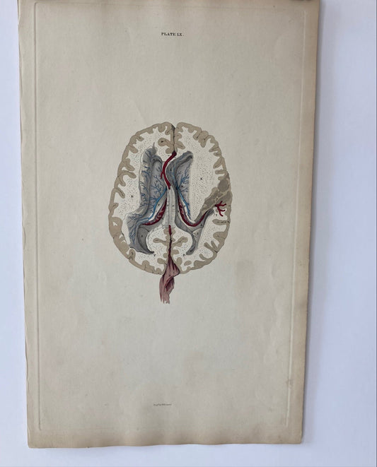 early anatomy - plate LX - ORIGINAL - Room Four