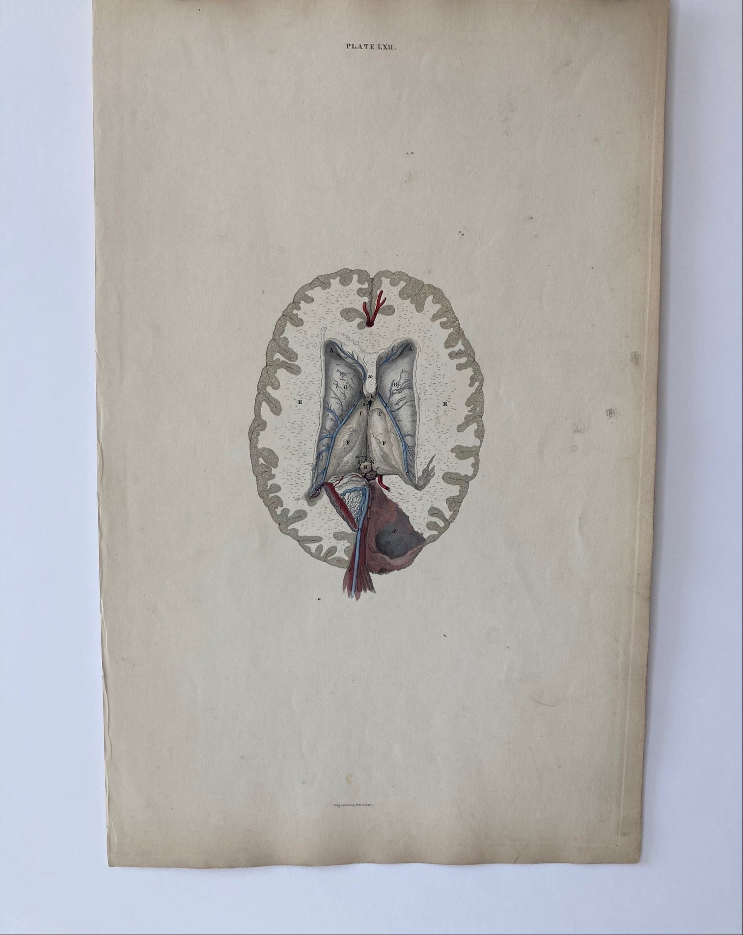 early anatomy - plate LXII - ORIGINAL - Room Four