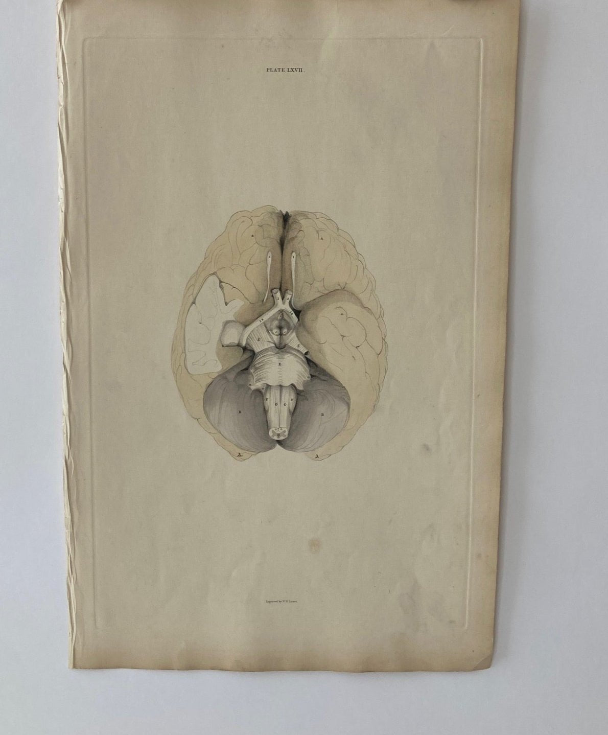 early anatomy - plate LXVII - original - Room Four