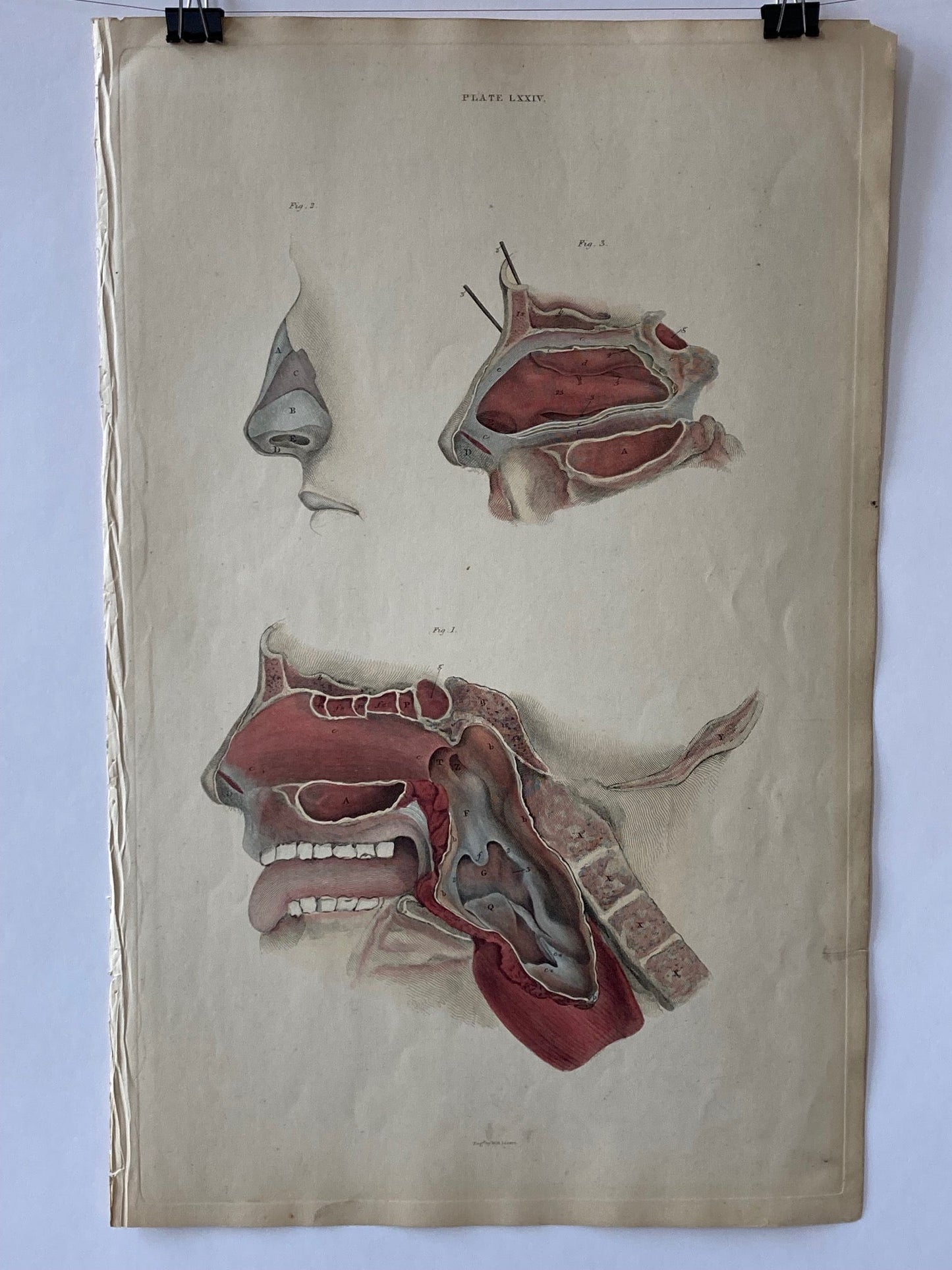 early anatomy - plate LXXIV - ORIGINAL - Room Four