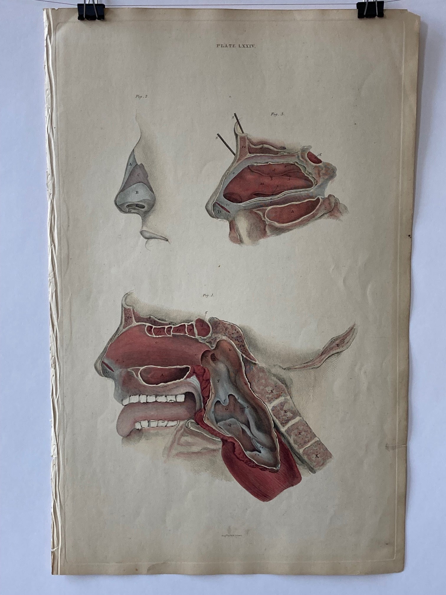early anatomy - plate LXXIV - ORIGINAL - Room Four