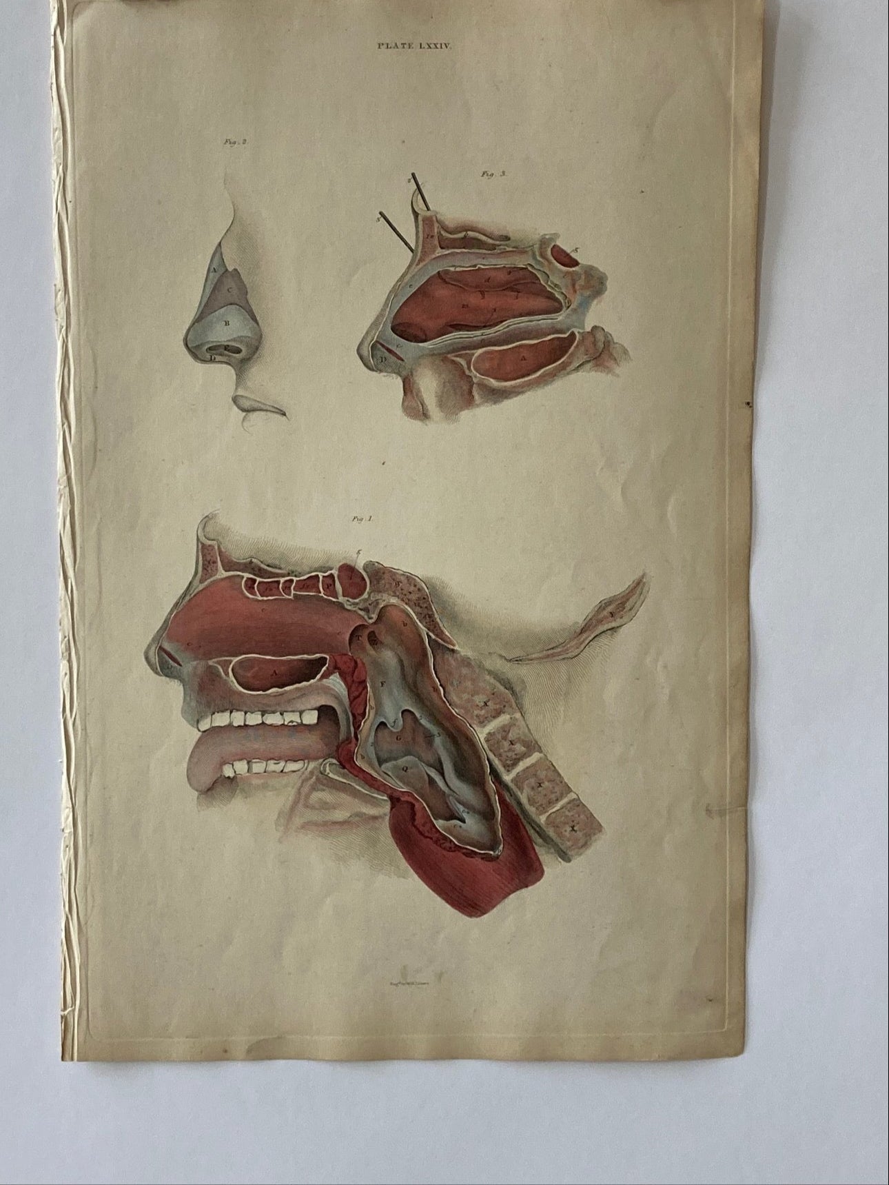 early anatomy - plate LXXIV - ORIGINAL - Room Four