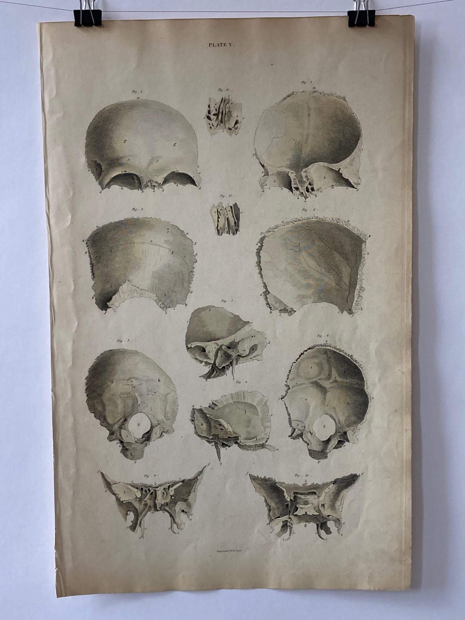 Early Anatomy - Plate V - ORIGINAL - Room Four