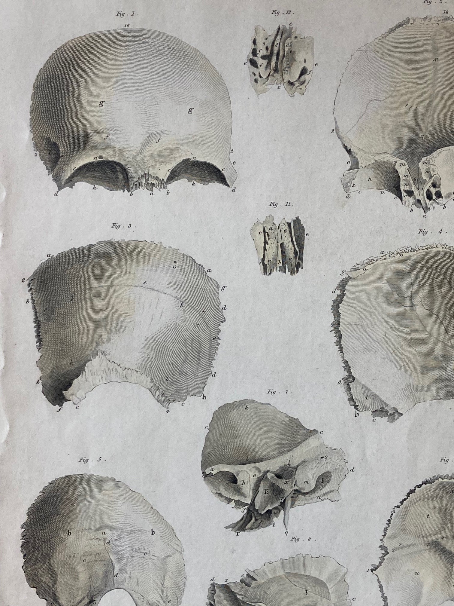 Early Anatomy - Plate V - ORIGINAL - Room Four