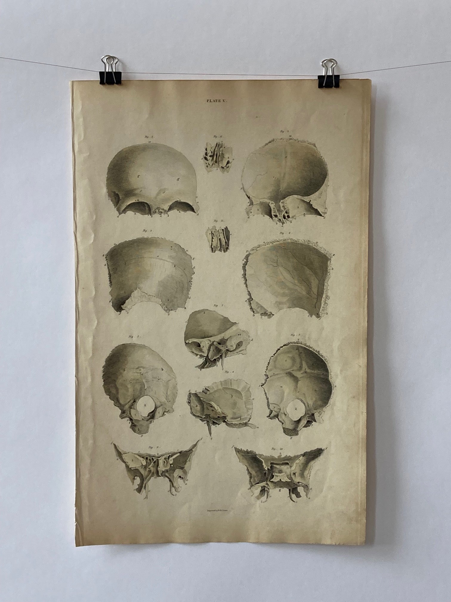 Early Anatomy - Plate V - ORIGINAL - Room Four