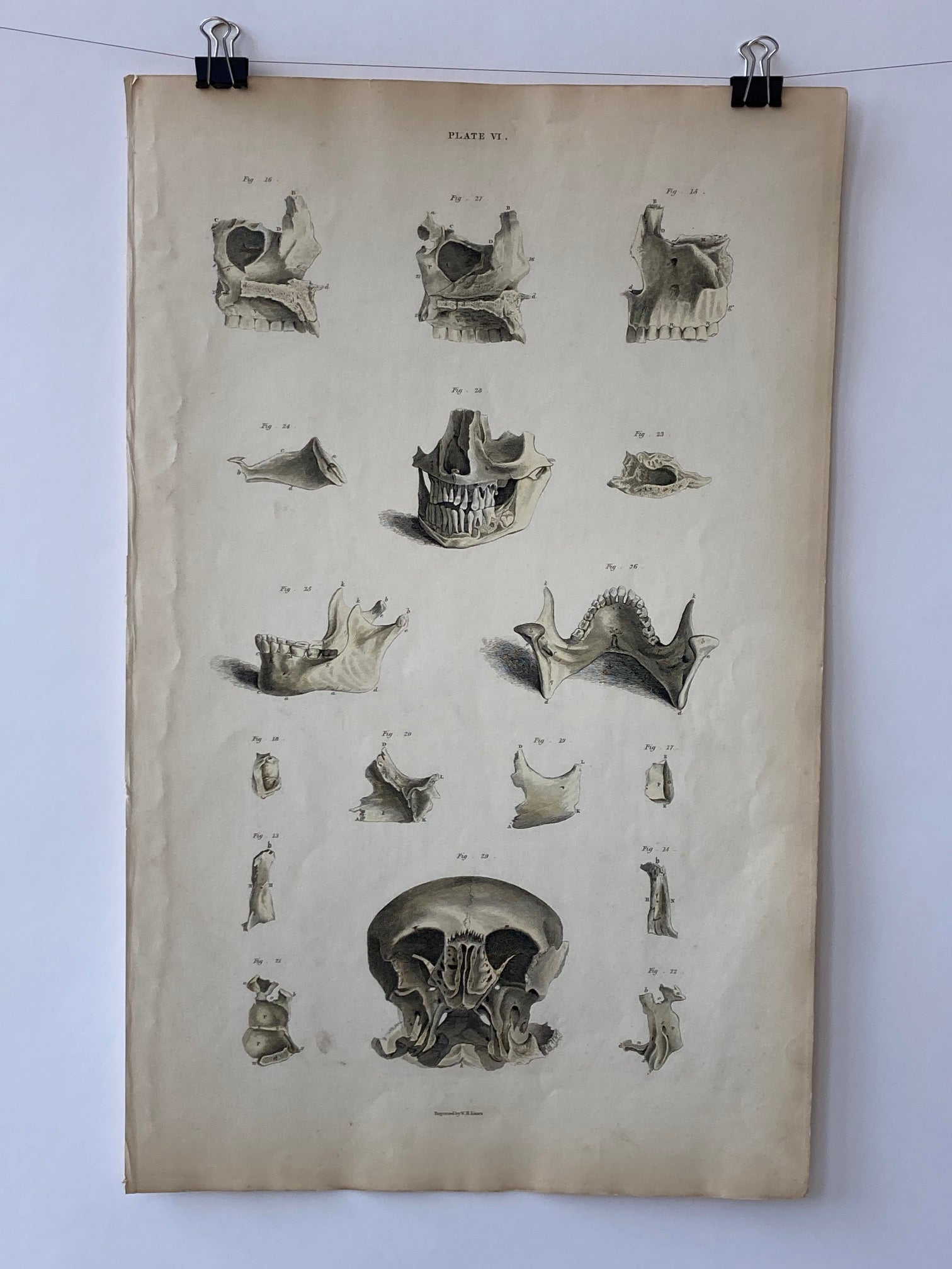 early anatomy PLATE VI - ORIGINAL - Room Four