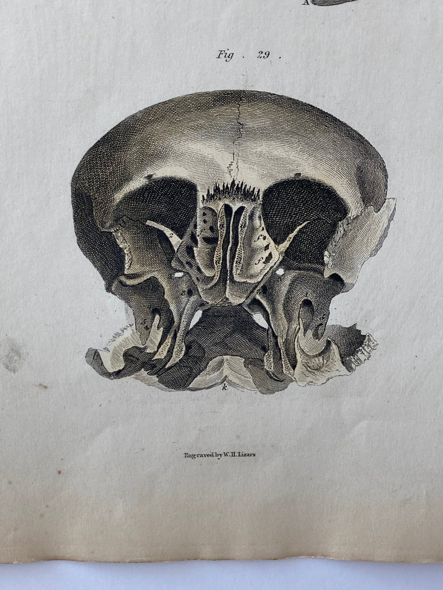 early anatomy PLATE VI - ORIGINAL - Room Four