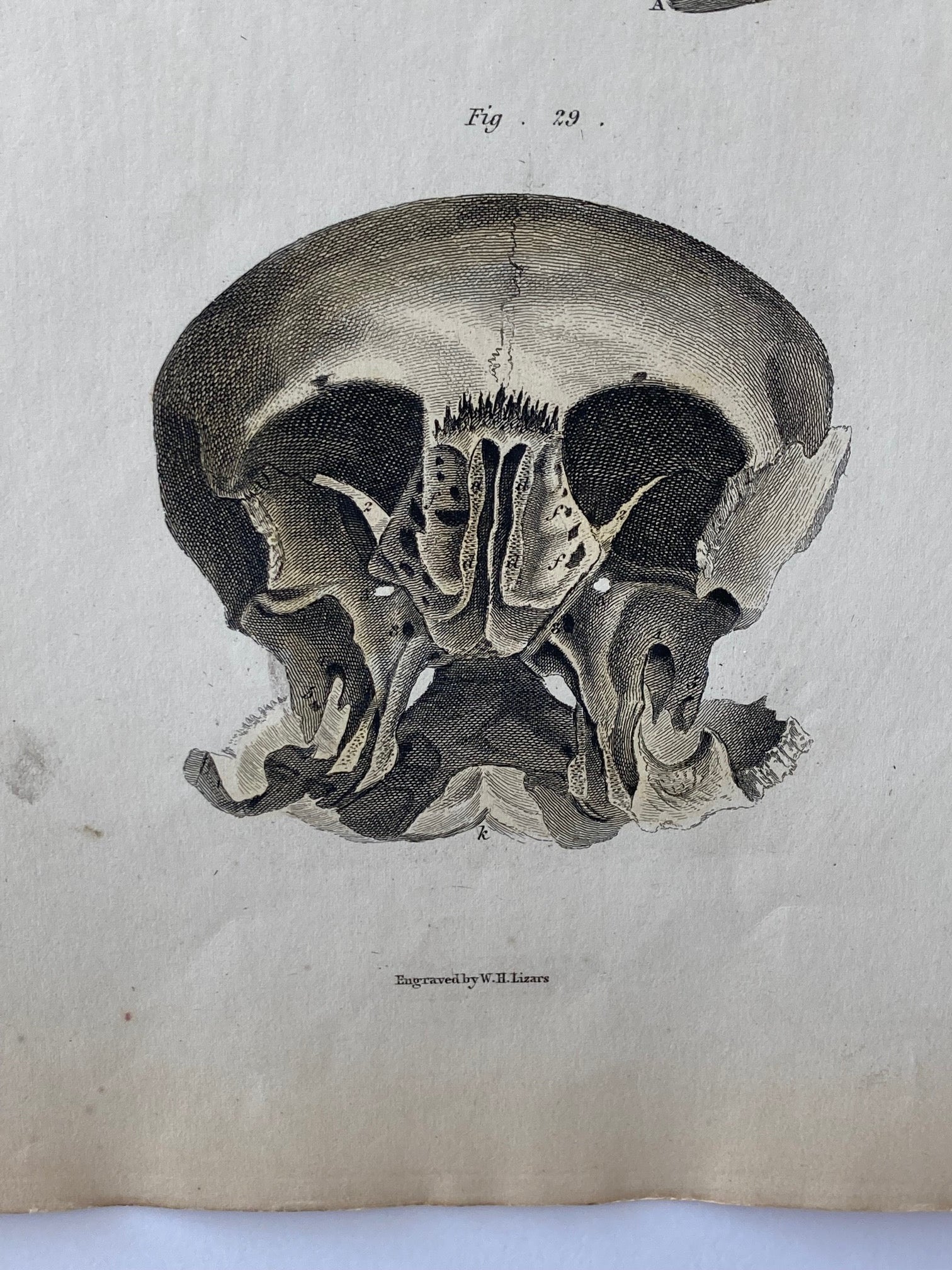 early anatomy PLATE VI - ORIGINAL - Room Four