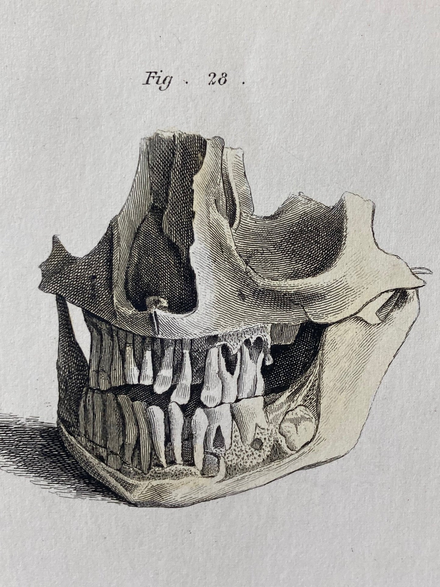 early anatomy PLATE VI - ORIGINAL - Room Four