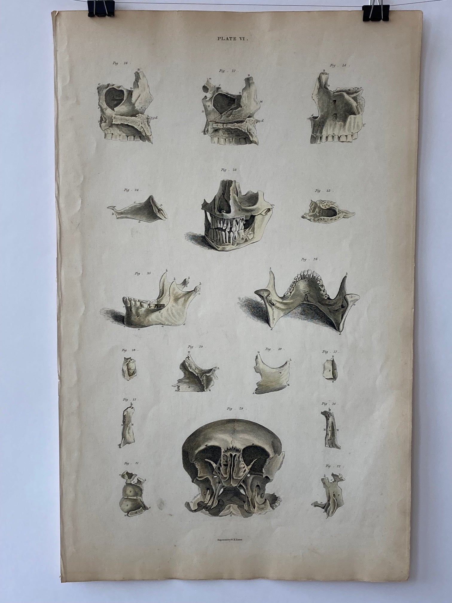 early anatomy PLATE VI - ORIGINAL - Room Four