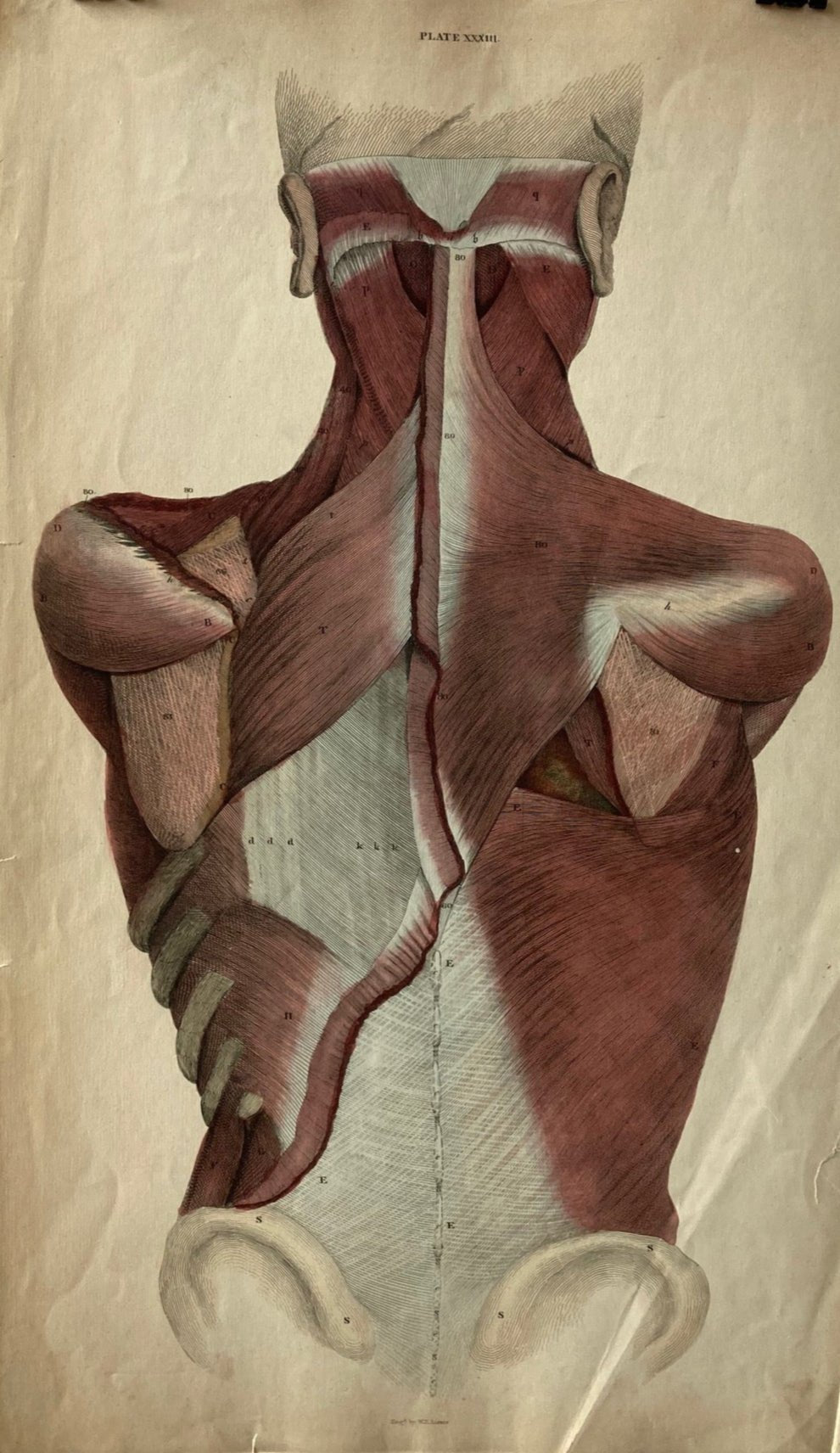 Sold early anatomy Plate XXXIII - original - Room Four